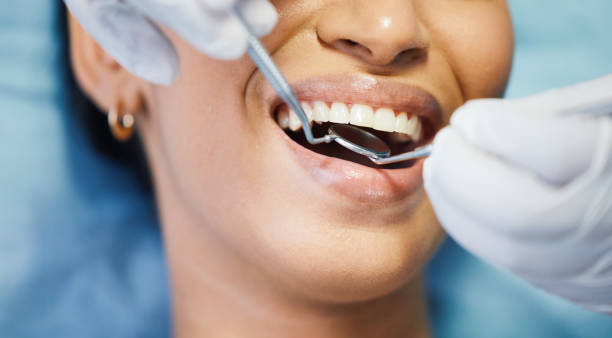 Best Broken or Cracked Tooth Emergency Dentist in Reedspt, OR